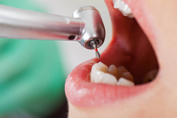 Best Walk-In Emergency Dentist in De Pere, WI